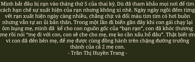 Vết nứt của đá trên bụng mẹ: Nỗi đau xé toạc thanh xuân nhưng là dấu ấn tuyệt đẹp của hành trình trưởng thành - Ảnh 24.